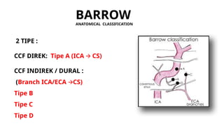 Cavernous Carotid Fistulas & TOLOSA HUNT.pptx