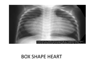 BOX SHAPE HEART
 