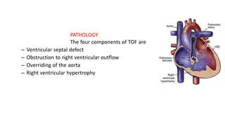 CCHD.pptx IN CHILDREN WITHOUT CONGESTIVE | PPTX