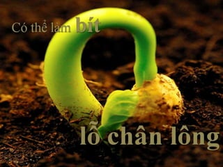 5 bí quyết xác định loại da để trị mụn