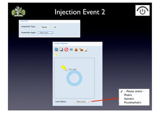 Injection Event 2