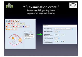 MR examination event 5
Automated DR grading slaved
to posterior segment drawing