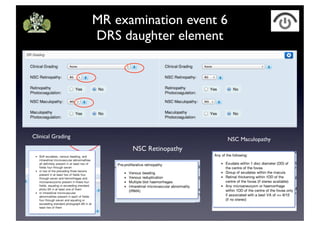 MR examination event 6
DRS daughter element
Clinical Grading
NSC Retinopathy
NSC Maculopathy