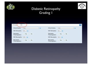 Diabetic Retinopathy
Grading 1