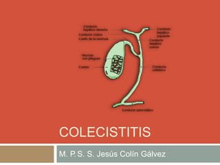 COLECISTITIS
M. P. S. S. Jesús Colín Gálvez
 