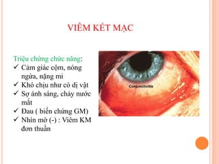 VIÊM KẾT MẠC
Triệu chứng chức năng:
 Cảm giác cộm, nóng
ngứa, nặng mi
 Khó chịu như có dị vật
 Sợ ánh sáng, chảy nước
mắt
 Đau ( biến chứng GM)
 Nhìn mờ (-) : Viêm KM
đơn thuần
 