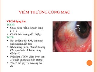 VIÊM THƯỢNG CỦNG MẠC
VTCM dạng hạt
TCCN:
 Chảy nước mắt & sợ ánh sáng
(+++)
 Có thể ảnh hưởng đến thị lực
TCTT:
 Hạt gồ lên dưới KM, tân mạch
xung quanh, rất đau
 KM cương tụ rìa, phù nề thượng
CM quanh rìa  biến chứng
GM (+/-)
 Phần lớn VTCM giảm bệnh sau
3-6 tuần không có biến chứng
 7% có thể gây viêm màng bồ
đào
 