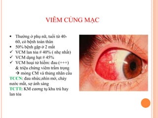 VIÊM CỦNG MẠC
 Thường ở phụ nữ, tuổi từ 40-
60, có bệnh toàn thân
 50% bệnh gặp ở 2 mắt
 VCM lan tỏa # 40% ( nhẹ nhất)
 VCM dạng hạt # 45%
 VCM hoại tử hiếm: đau (+++)
& triệu chứng viêm trầm trọng
 mỏng CM và thủng nhãn cầu
TCCN: đau nhức,nhìn mờ, chảy
nước mắt, sợ ánh sáng
TCTT: KM cương tụ khu trú hay
lan tỏa
 