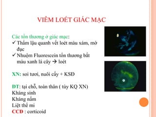 VIÊM LOÉT GIÁC MẠC
Các tổn thương ở giác mạc:
 Thẩm lậu quanh vết loét màu xám, mờ
đục
 Nhuộm Fluorescein tổn thương bắt
màu xanh lá cây  loét
XN: soi tươi, nuôi cấy + KSĐ
ĐT: tại chỗ, toàn thân ( tùy KQ XN)
Kháng sinh
Kháng nấm
Liệt thể mi
CCĐ : corticoid
 