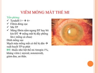 VIÊM MỐNG MẮT THỂ MI
Tiền phòng:
 Tyndalll 1+  4+
 Fibrin đóng cục
 Mủ TP
 Màng fibrin nằm ngang ĐT hay bít
kín ĐT  mống mắt bị đẩy phồng
lên ( mống cà chua)
Dính mống sau
Mạch máu mống mắt có thể bị dãn 
xuất huyết TP tự phát
ĐT: thuốc nhỏ liệt thể mi Atropin 1%,
kháng viêm ( steroid, nonsteroid),
giảm đau, an thần.
 
