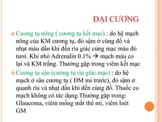 ĐẠI CƯƠNG
 Cương tụ nông ( cương tụ kết mạc) : do hệ mạch
nông của KM cương tụ, đỏ sậm ở cùng đồ và
nhạt màu dần khi đến rìa giác củng mạc màu đỏ
tươi. Khi nhỏ Adrenalin 0.1%  mạch máu co
lại và KM trắng. Thường gặp trong viêm kết mạc
 Cương tụ sâu (cương tụ rìa giác mạc) : do hệ
mạch ở sâu cương tụ ( ĐM mi trước), đỏ sậm ở
quanh rìa và nhạt dần khi đến cùng đồ. Thuốc co
mạch không có tác dụng.Thường gặp trong:
Glaucoma, viêm mống mắt thể mi, viêm loét
GM
 