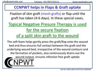 info@npwtindia.com

Contact: +91 9971722111

www.npwtindia.com

CCNPWT helps in Flaps & Graft uptake
Fixation of skin graft (mesh-grafts) or flap until the
graft has taken (4-6 days). In these special cases,

Topical Negative Presure Therapy is used
for the secure fixation
of a split skin graft to the wound
The soft foam helps gently press the graft/flap onto the wound
bed and thus ensures full contact between the graft and the
underlying wound bed, irrespective of the wound contours and
the formation of pockets, also continuously drains out the
wound output, ensures infection free graft uptake

AN ISO 13485:2003 CERTIFIED COMPANY

 