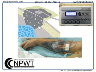 info@npwtindia.com

Contact: +91 9971722111

www.npwtindia.com

AN ISO 13485:2003 CERTIFIED COMPANY

 