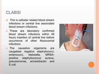 CLABSI
 This is catheter related blood stream
infections or central line associated
blood stream infections.
 These are laboratory confirmed
blood stream infections within 48
hours insertion of central line before
occurrence of other Nosocomial
infections
 The causative organisms are
caugalase negative staphylococci,
enterococci, klebsiella, MRSA-
positive staphylococcus aureus,
pseudomonas, acinetobactor and
E.coli.
 