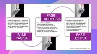 • Los arcos pequeños y redondos
se deslizan libremente, iniciando
el proceso de movimiento de los
dientes a medida que el arco
iguala suavemente los dientes y
los dirige a su alineación.
FASE
PASIVA
• Los arcos cuadrados o
rectangulares se asientan
suavemente en la base de la
ranura sin contactar con el clip.
La programación se expresa, las
rotaciones se corrigen y los
cierres de espacios se terminan.
FASE
EXPRESIVA • Los arcos rectangulares se
extienden más allá de la ranura
para contactar completamente
con el clip, proporcionando el
control activo necesario para un
terminado funcional,
enderezando las raíces y
ajustando el torque.
FASE
ACTIVA
Secchi AG. Complete Clinical Orthodontics. 2010
 