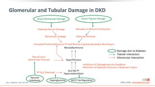 Glomerular and Tubular Damage in DKD
Zeni. J Nephrol. 2017;30:701. Slide credit: clinicaloptions.com
Direct Glomerular Damage Direct Tubular Damage
Decrease in Albumin Endocytosis
Podocyte Barrier Damage
Glomerular Leakage Reduced Retrieval
Increased Protein Delivery to PT and Reserve Capacity Exceeded, Resulting in
Microalbuminuria
GLU-Na PT
Hyperreabsorbtion
Hyperfiltration
Vascular
Imbalance Hyperglycemia SGLT2 Up-Regulation
Damage due to diabetes
Tubular interaction
Glomerular interaction
Rise of Intra-
Glomerular Pressure
Inhibition of Tubuloglomerular Feedback
Reduction of Hydraulic Pressure in Bowman’s Space
PT GLU Overload
 