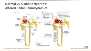 Normal vs. Diabetic Nephron:
Altered Renal Hemodynamics
Alicic. CJASN. 2017;12:2032. Reproduced with permission. Slide credit: clinicaloptions.com
 