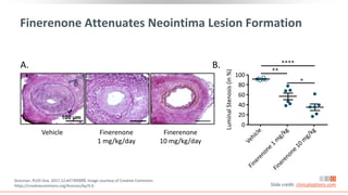 Finerenone Attenuates Neointima Lesion Formation
Dutzman. PLOS One. 2017;12:e0184888. Image courtesy of Creative Commons:
https://creativecommons.org/licenses/by/4.0. Slide credit: clinicaloptions.com
Vehicle Finerenone
1 mg/kg/day
Finerenone
10 mg/kg/day
A. B.
100
80
60
40
20
0
Luminal
Stenosis
(in
%)
*
**
****
 