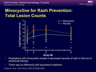 clinicaloptions.com/oncology
EGFR Inhibitor–Related Dermatologic Toxicities
Minocycline for Rash Prevention:
Total Lesion Counts
 Prophylaxis with minocycline results in decreased severity of rash in first mo of
cetuximab therapy
 There was no difference with tazarotene treatment
Scope A, et al. J Clin Oncol. 2007;25:5390-5396.
7
6
5
4
3
2
1
0
Log-TotalLesionCount
Study Wk
1 2 4 8
Minocycline
Placebo
 