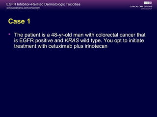 clinicaloptions.com/oncology
EGFR Inhibitor–Related Dermatologic Toxicities
Case 1
 The patient is a 48-yr-old man with colorectal cancer that
is EGFR positive and KRAS wild type. You opt to initiate
treatment with cetuximab plus irinotecan
 