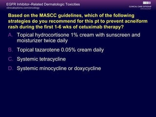 clinicaloptions.com/oncology
EGFR Inhibitor–Related Dermatologic Toxicities
A. Topical hydrocortisone 1% cream with sunscreen and
moisturizer twice daily
B. Topical tazarotene 0.05% cream daily
C. Systemic tetracycline
D. Systemic minocycline or doxycycline
Based on the MASCC guidelines, which of the following
strategies do you recommend for this pt to prevent acneiform
rash during the first 1-6 wks of cetuximab therapy?
 