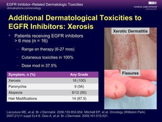 clinicaloptions.com/oncology
EGFR Inhibitor–Related Dermatologic Toxicities
Additional Dermatological Toxicities to
EGFR Inhibitors: Xerosis
 Patients receiving EGFR inhibitors
> 6 mos (n = 16)
– Range on therapy (6-27 mos)
– Cutaneous toxicities in 100%
– Dose mod in 37.5%
Symptom, n (%) Any Grade
Xerosis 16 (100)
Paronychia 9 (56)
Alopecia 6/12 (50)
Hair Modifications 14 (87.5)
Xerotic Dermatitis
Fissures
Lacouture ME, et al. Br J Dermatol. 2006;155:852-854. Mitchell EP, et al. Oncology (Williston Park).
2007;21(11 suppl 5):4-9. Osio A, et al. Br J Dermatol. 2009;161:515-521.
 