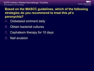 clinicaloptions.com/oncology
EGFR Inhibitor–Related Dermatologic Toxicities
Based on the MASCC guidelines, which of the following
strategies do you recommend to treat this pt’s
paronychia?
A. Clobetasol ointment daily
B. Obtain bacterial cultures
C. Cephalexin therapy for 10 days
D. Nail avulsion
 