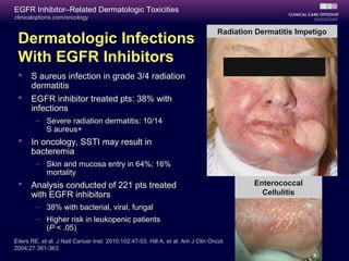 clinicaloptions.com/oncology
EGFR Inhibitor–Related Dermatologic Toxicities
Eilers RE, et al. J Natl Cancer Inst. 2010;102:47-53. Hill A, et al. Am J Clin Oncol.
2004;27:361-363.
Enterococcal
Cellulitis
Radiation Dermatitis Impetigo
Dermatologic Infections
With EGFR Inhibitors
 S aureus infection in grade 3/4 radiation
dermatitis
 EGFR inhibitor treated pts: 38% with
infections
– Severe radiation dermatitis: 10/14
S aureus+
 In oncology, SSTI may result in
bacteremia
– Skin and mucosa entry in 64%; 16%
mortality
 Analysis conducted of 221 pts treated
with EGFR inhibitors
– 38% with bacterial, viral, fungal
– Higher risk in leukopenic patients
(P < .05)
 
