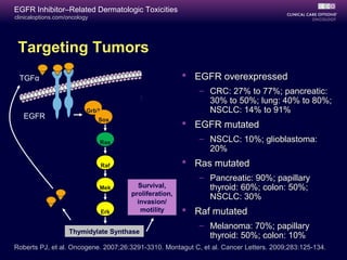 clinicaloptions.com/oncology
EGFR Inhibitor–Related Dermatologic Toxicities
Thymidylate Synthase
Grb2
Ras
Sos
Raf
Mek
Erk
Targeting Tumors
Survival,
proliferation,
invasion/
motility
EGFR
TGFα
Roberts PJ, et al. Oncogene. 2007;26:3291-3310. Montagut C, et al. Cancer Letters. 2009;283:125-134.
 EGFR overexpressed
– CRC: 27% to 77%; pancreatic:
30% to 50%; lung: 40% to 80%;
NSCLC: 14% to 91%
 EGFR mutated
– NSCLC: 10%; glioblastoma:
20%
 Ras mutated
– Pancreatic: 90%; papillary
thyroid: 60%; colon: 50%;
NSCLC: 30%
 Raf mutated
– Melanoma: 70%; papillary
thyroid: 50%; colon: 10%
 