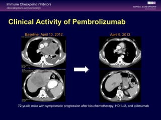 clinicaloptions.com/oncology
Immune Checkpoint Inhibitors
Clinical Activity of Pembrolizumab
Baseline: April 13, 2012
72-yr-old male with symptomatic progression after bio-chemotherapy, HD IL-2, and ipilimumab
April 9, 2013
 