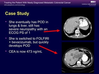 Treating the Patient With Newly Diagnosed Metastatic Colorectal Cancer
clinicaloptions.com/oncology




 Case Study
  She eventually has POD in
   lungs & liver, still has
   severe neuropathy with an
   ECOG PS of 1
  She is switched to FOLFIRI
   + bevacizumab, but quickly
   develops POD
  CEA is now 473 ng/mL
 