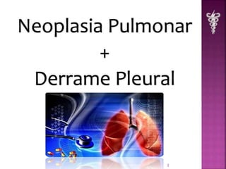 Neoplasia Pulmonar 
+ 
Derrame Pleural 
2 
 