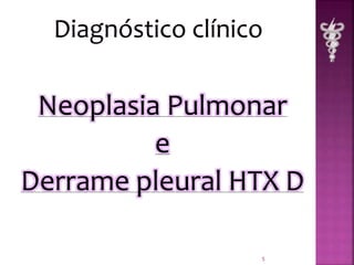 Neoplasia Pulmonar 
e 
Derrame pleural HTX D 
5 
 