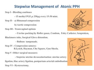 Stepwise Management of Atonic PPH
Step I - Bleeding continues
- 15 methyl PGF2 250g every 15-30 mint.
Step II - a) Bimanual compression
b) Aortic compression
Step III - Transvaginal options
- Uterine packing:by Roller gauze, Condom, Foley Catheter, Sengstaken,
Blackmore tube, Surgical Glove distention.
- Balloon tamponade.
Step IV - Compression sutures:
B.Lynch, Hayman, Cho Square, Gun Sheela.
Step V -Other surgical measures
- Stepwise uterine devascularisation: uterine artery
ligation, iliac artery ligation, postpartum arterial embolisation
Step VI - Hysterectomy.
 