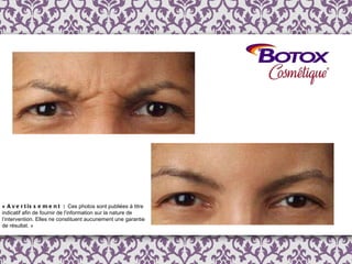 «  Avertissement :  Ces photos sont publi é es  à  titre indicatif afin de fournir de l ’ information  sur la nature de l’intervention. Elles ne constituent aucunement une garantie de résultat. » 