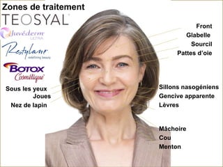 Sillons nasogéniens Gencive apparente  Lèvres  Front Glabelle  Sourcil Pattes d’oie Mâchoire Cou Menton Zones de traitement Sous les yeux Joues Nez de lapin 