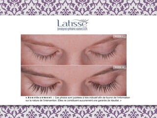 «  Avertissement :  Ces photos sont publi é es  à  titre indicatif afin de fournir de l ’ information  sur la nature de l’intervention. Elles ne constituent aucunement une garantie de résultat. » 