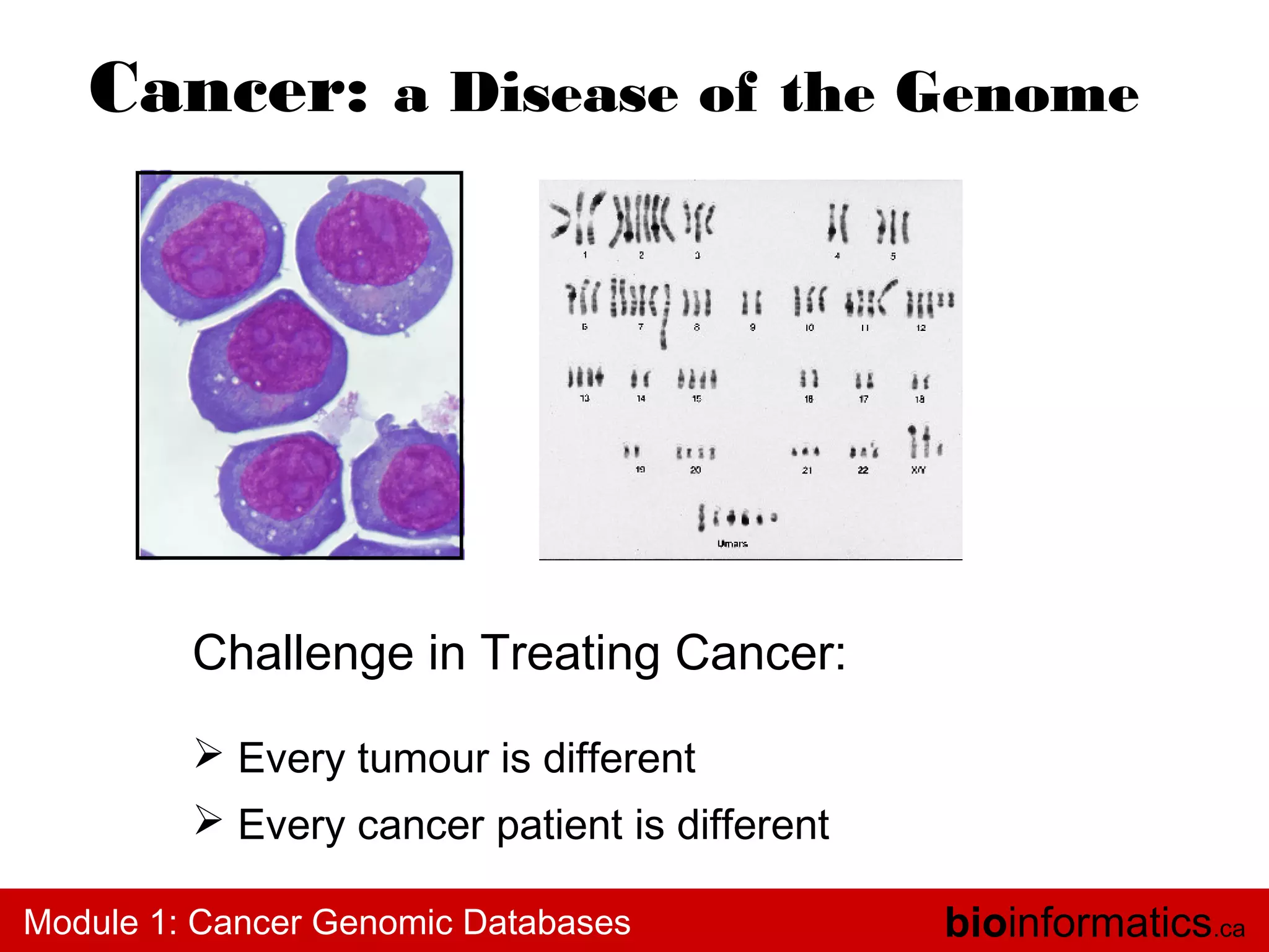 Cancer: a Disease of the Genome

Challenge in Treating Cancer:
 Every tumour is different
 Every cancer patient is different
Module 1: Cancer Genomic Databases

bioinformatics.ca

 