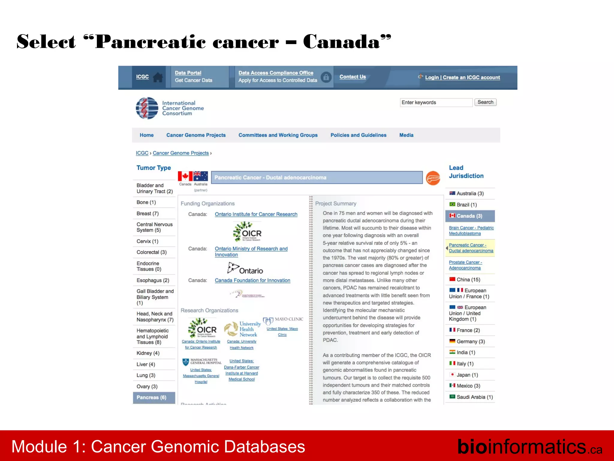 Select “Pancreatic cancer – Canada”

Module 1: Cancer Genomic Databases

bioinformatics.ca

 