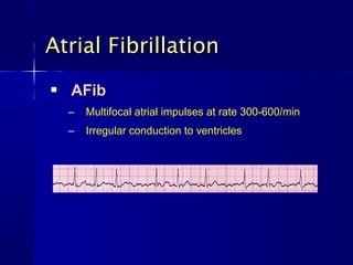 Atrial Fibrillation
   AFib
    –   Multifocal atrial impulses at rate 300-600/min
    –   Irregular conduction to ventricles
 