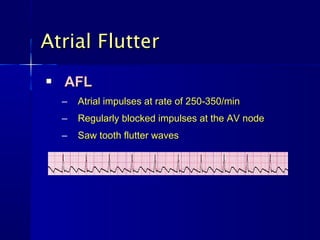 Atrial Flutter
   AFL
    –   Atrial impulses at rate of 250-350/min
    –   Regularly blocked impulses at the AV node
    –   Saw tooth flutter waves
 