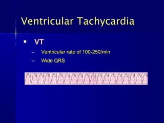 Ventricular Tachycardia
   VT
    –   Ventricular rate of 100-250/min
    –   Wide QRS
 