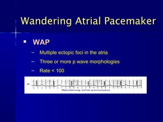 Wandering Atrial PacemakerWandering Atrial Pacemaker

WAPWAP
– Multiple ectopic foci in the atriaMultiple ectopic foci in the atria
– Three or more p wave morphologiesThree or more p wave morphologies
– Rate < 100Rate < 100
 