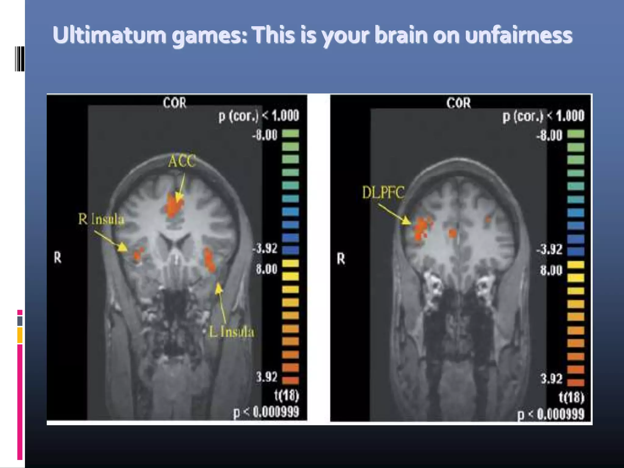 Ultimatum games:This is your brain on unfairness
 