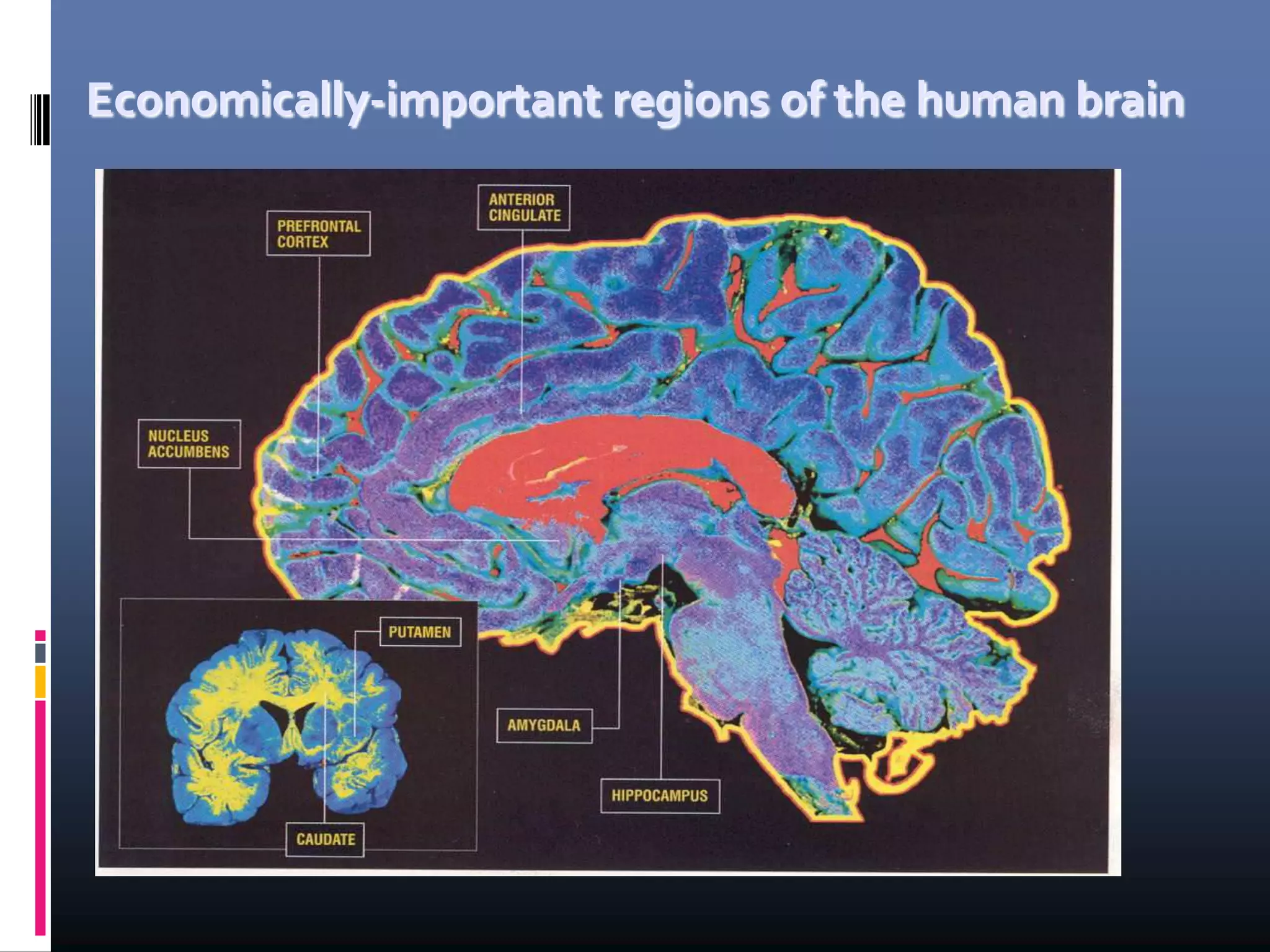 Economically-important regions of the human brain
 