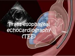 Trans-esophageal
echocardiography
     (TEE)
 