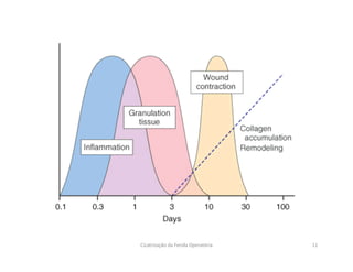Cicatrização da Ferida Operatória 11
 