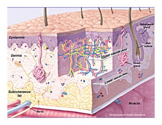 Cicatrização da Ferida Operatória
13
 