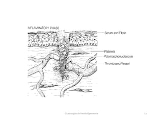 15Cicatrização da Ferida Operatória
 