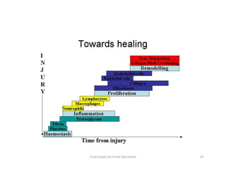 18Cicatrização da Ferida Operatória
 